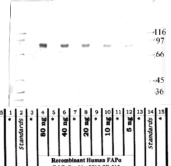 Anti-FAP Rabbit Polyclonal Antibody