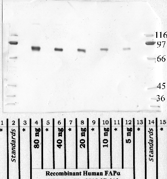 Anti-FAP Rabbit Polyclonal Antibody