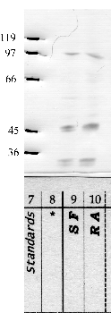 Anti-DPP10 Rabbit Polyclonal Antibody
