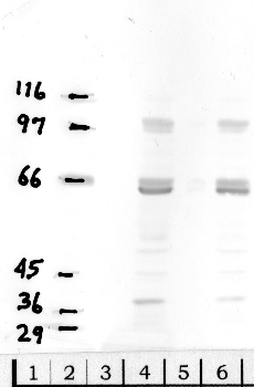Anti-DPP8 Rabbit Polyclonal Antibody
