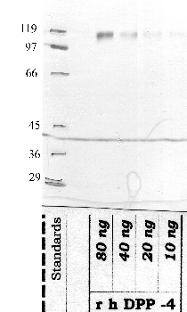 Anti-DPP4 Rabbit Polyclonal Antibody