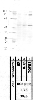 Anti-MMP21 Rabbit Polyclonal Antibody