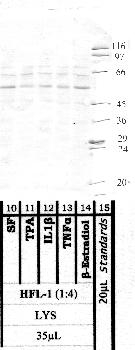 Anti-MMP21 Rabbit Polyclonal Antibody