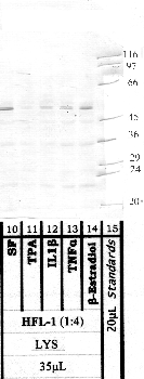 Anti-MMP19 Rabbit Polyclonal Antibody