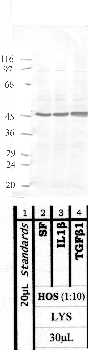 Anti-MMP17 Rabbit Polyclonal Antibody