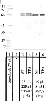 Anti-MMP16 Rabbit Polyclonal Antibody