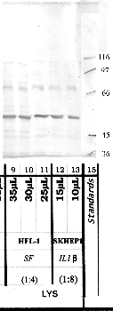 Anti-DPP3 Rabbit Polyclonal Antibody