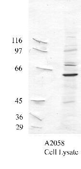 Anti-ADAMTS17 Rabbit Polyclonal Antibody
