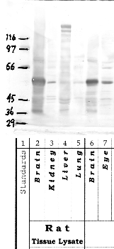 Anti-ADAMTS14 Rabbit Polyclonal Antibody