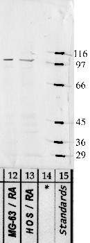 Anti-ADAMTS10 Rabbit Polyclonal Antibody