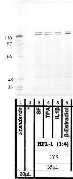Anti-ADAMTS7 Rabbit Polyclonal Antibody