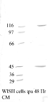 Anti-ADAMTS6 Rabbit Polyclonal Antibody