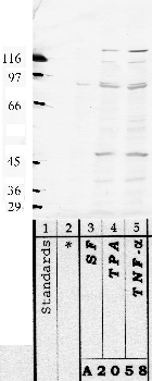 Anti-ADAMTS3 Rabbit Polyclonal Antibody