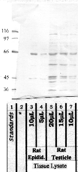 Anti-ADAM21 Rabbit Polyclonal Antibody