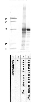 Anti-ADAM21 Rabbit Polyclonal Antibody