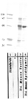 Anti-ADAM20 Rabbit Polyclonal Antibody