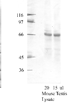 Anti-ADAM20 Rabbit Polyclonal Antibody