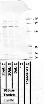 Anti-ADAM18 Rabbit Polyclonal Antibody
