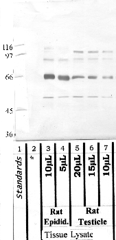 Anti-ADAM7 Rabbit Polyclonal Antibody