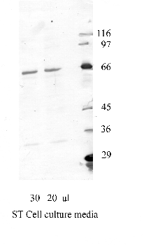 Anti-ADAM7 Rabbit Polyclonal Antibody