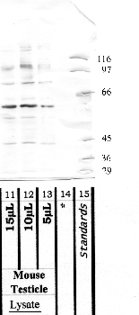 Anti-ADAM2 Rabbit Polyclonal Antibody