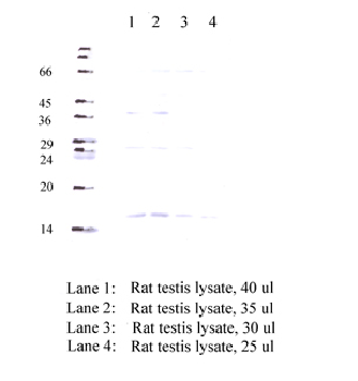 Anti-CST11 Rabbit Polyclonal Antibody