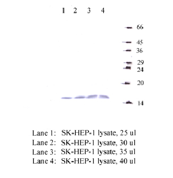 Anti-CST11 Rabbit Polyclonal Antibody