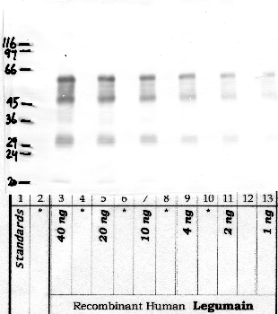 Anti-LGMN Rabbit Polyclonal Antibody
