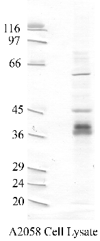 Anti-CTSW Rabbit Polyclonal Antibody