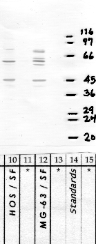 Anti-CAPN15 Rabbit Polyclonal Antibody