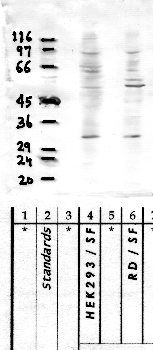 Anti-CAPN15 Rabbit Polyclonal Antibody