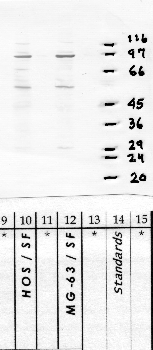 Anti-CAPN15 Rabbit Polyclonal Antibody