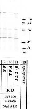 Anti-CAPN15 Rabbit Polyclonal Antibody