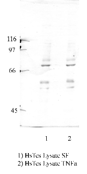 Anti-CAPN11 Rabbit Polyclonal Antibody