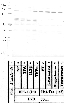 Anti-CAPN11 Rabbit Polyclonal Antibody