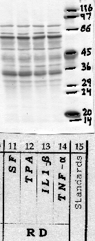 Anti-CAPN3 Rabbit Polyclonal Antibody