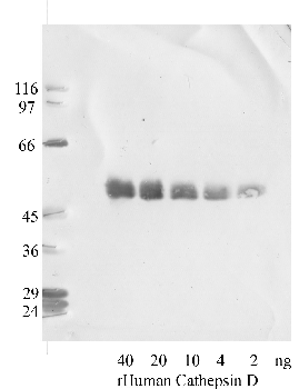 Anti-CTSD Rabbit Polyclonal Antibody