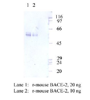 Anti-BACE2 Rabbit Polyclonal Antibody