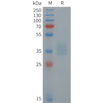 Cynomolgus IgHE Protein, His Tag