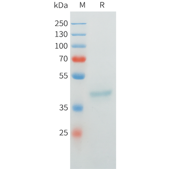 Mouse RNASE4 Protein, His Tag