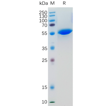 Human GPR75 Protein, hFc Tag