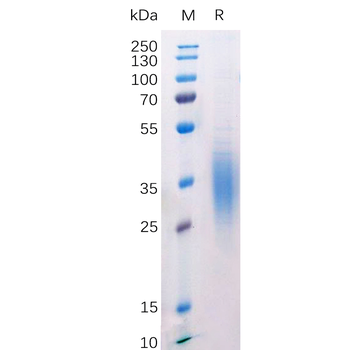 Human MMP13 Protein, hFc Tag
