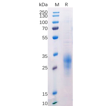 Human MMP13 Protein, His Tag