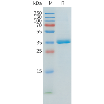 Mouse VWF (23-2813) Protein, His Tag