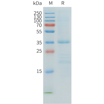 Mouse VWF (764-2813) Protein, His Tag