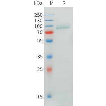 Mouse VWF (23-763) Protein, His Tag