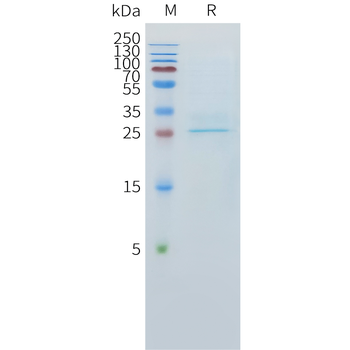 Mouse IFNB1 Protein, His Tag