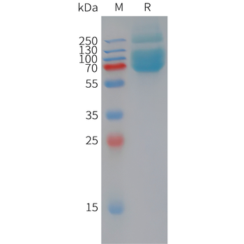 Rhesus macaque NCL Protein, His Tag