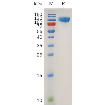 Human IL21 Protein, hFc Tag
