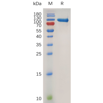 Human CD43 Protein, hFc Tag